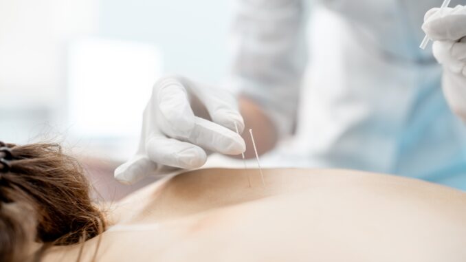 Acupuncture medical treatment Acupuncture medical treatment