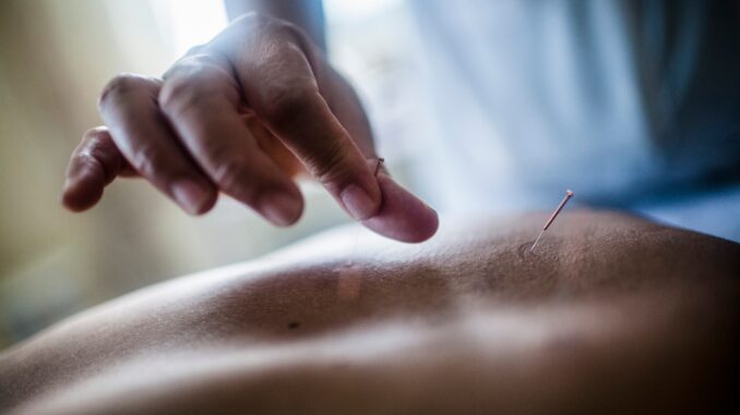 Close up of hand holding fine needle, performing acupuncture on a patient's back Close up of hand holding fine needle, performing acupuncture on a patient's back