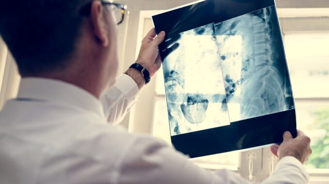 Doctor is checking patient x-ray film Doctor is checking patient x-ray film